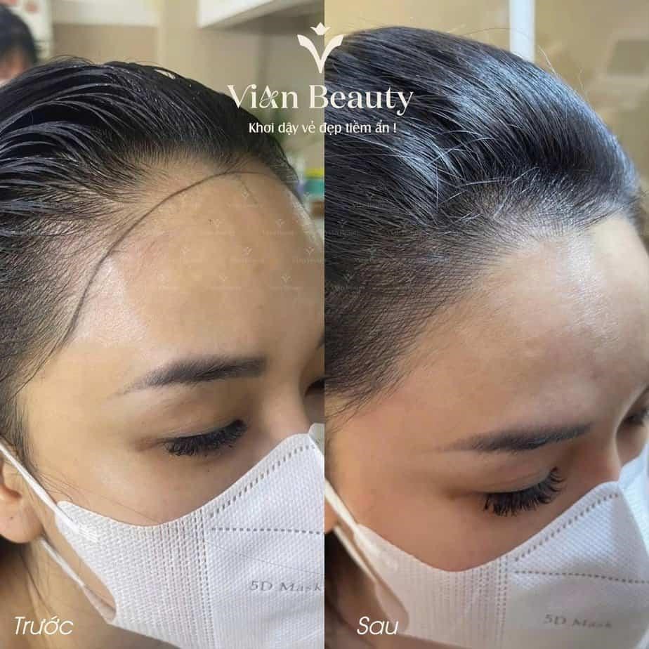 Vian Beauty: Điêu khắc sợi tóc - Có nên chi tiền cho dịch vụ này? 7